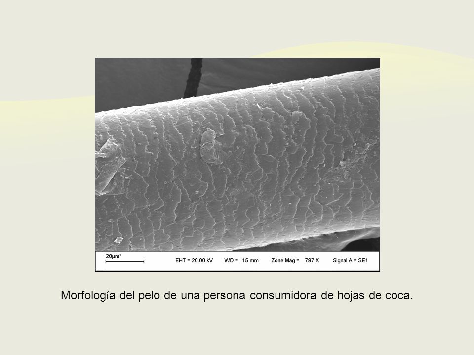 Morfología del pelo de una persona consumidora de hojas de coca.
