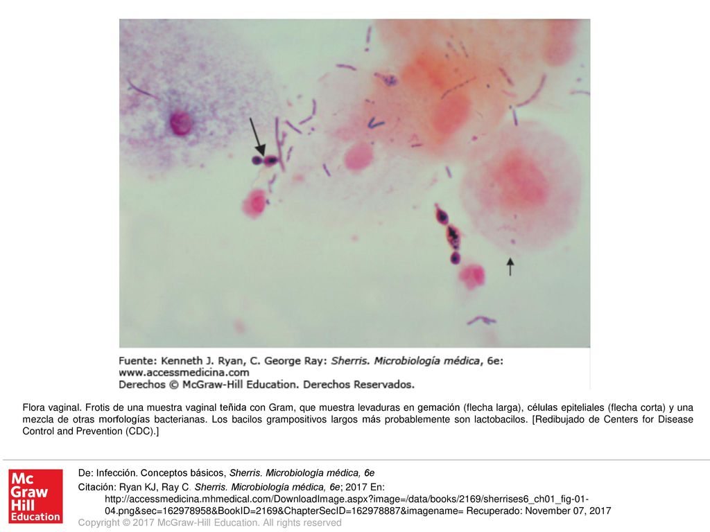 Flora vaginal. Frotis de una muestra vaginal teñida con Gram, que muestra levaduras en gemación (flecha larga), células epiteliales (flecha corta) y una mezcla de otras morfologías bacterianas. Los bacilos grampositivos largos más probablemente son lactobacilos. [Redibujado de Centers for Disease Control and Prevention (CDC).]