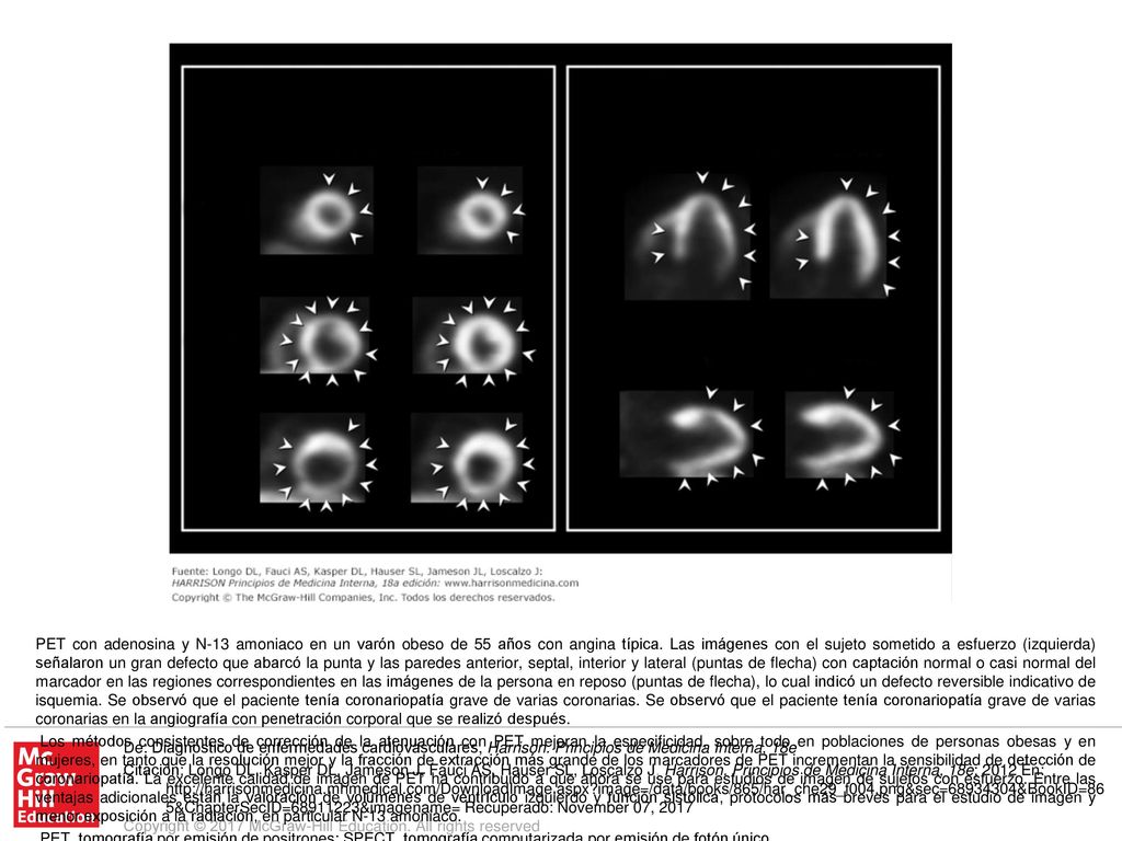 PET, tomografía por emisión de positrones; SPECT, tomografía computarizada por emisión de fotón único.