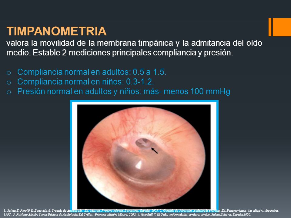 TIMPANOMETRIA valora la movilidad de la membrana timpánica y la admitancia del oído medio. Estable 2 mediciones principales compliancia y presión.