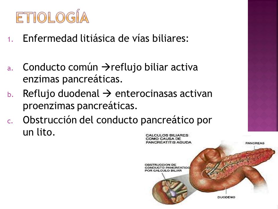 Etiología Enfermedad litiásica de vías biliares: