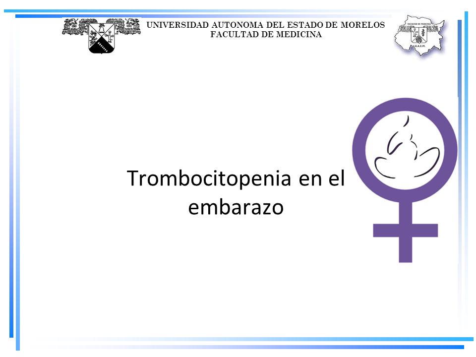 Trombocitopenia en el embarazo