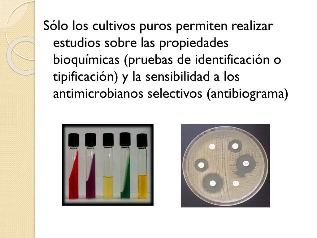 Sólo los cultivos puros permiten realizar estudios sobre las propiedades bioquímicas (pruebas de identificación o tipificación) y la sensibilidad a los antimicrobianos selectivos (antibiograma)