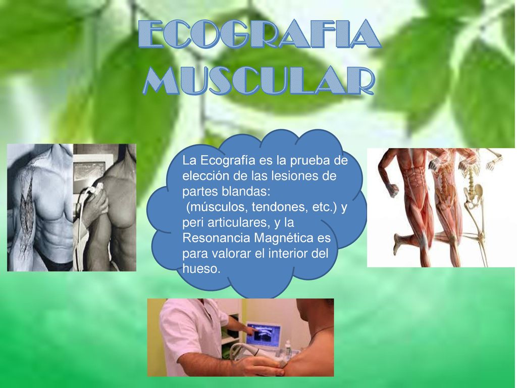 ECOGRAFIA MUSCULAR La Ecografía es la prueba de elección de las lesiones de partes blandas: