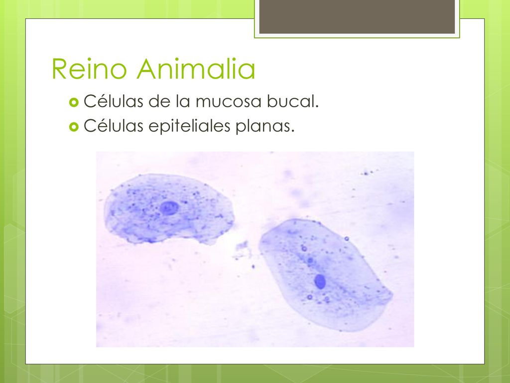 Reino Animalia Células de la mucosa bucal. Células epiteliales planas.