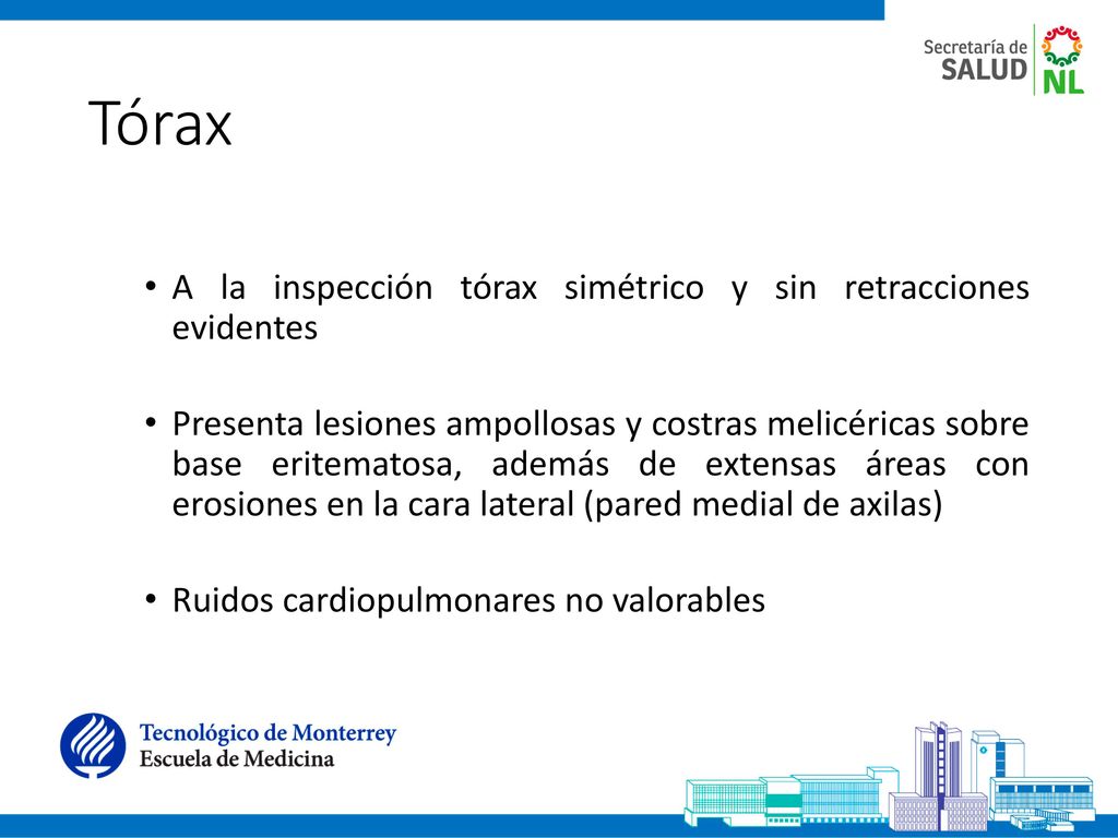 Tórax A la inspección tórax simétrico y sin retracciones evidentes