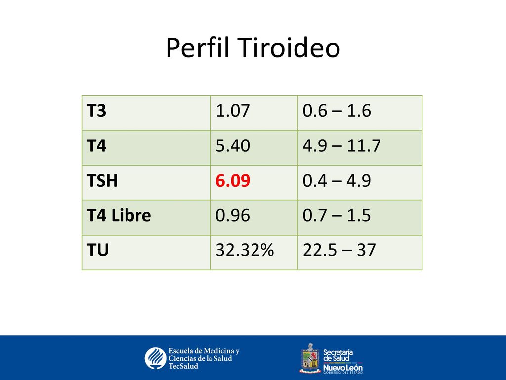 Perfil Tiroideo T – 1.6 T – 11.7 TSH 6.09