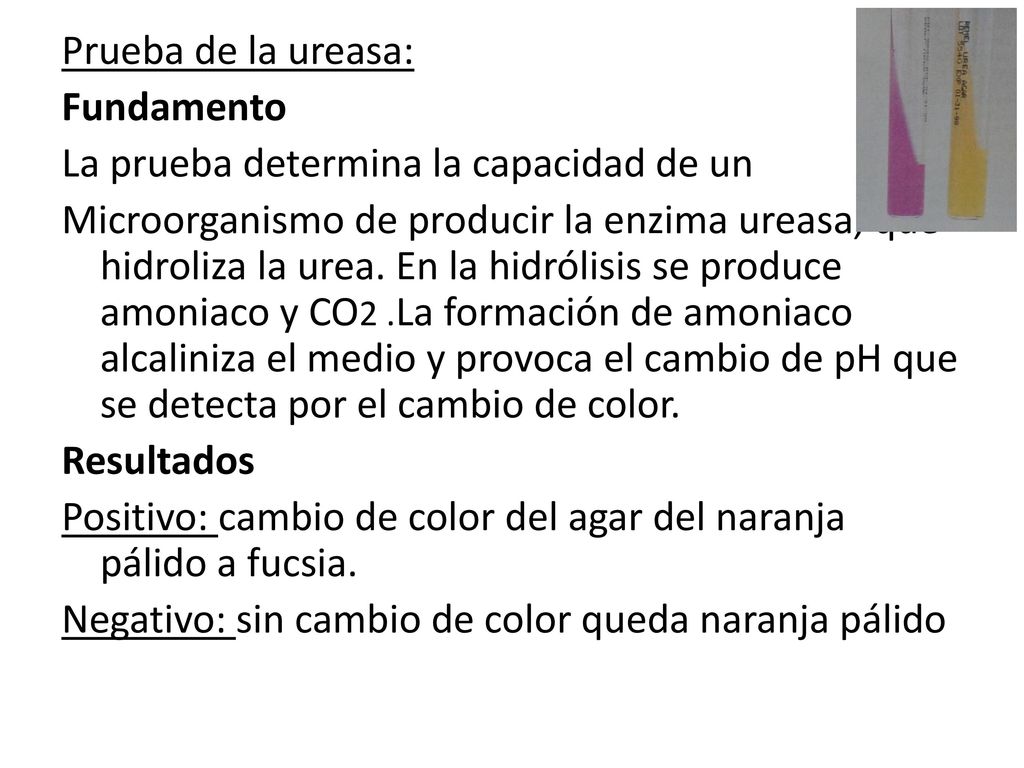 Prueba de la ureasa: Fundamento. La prueba determina la capacidad de un.