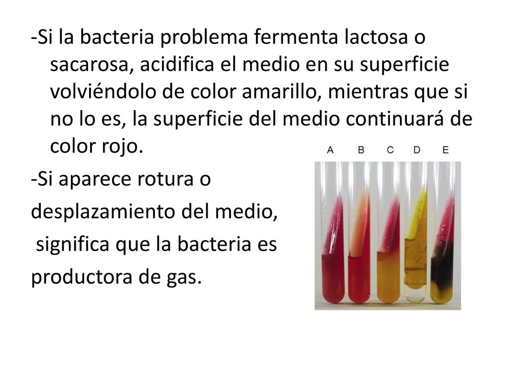 -Si la bacteria problema fermenta lactosa o sacarosa, acidifica el medio en su superficie volviéndolo de color amarillo, mientras que si no lo es, la superficie del medio continuará de color rojo.