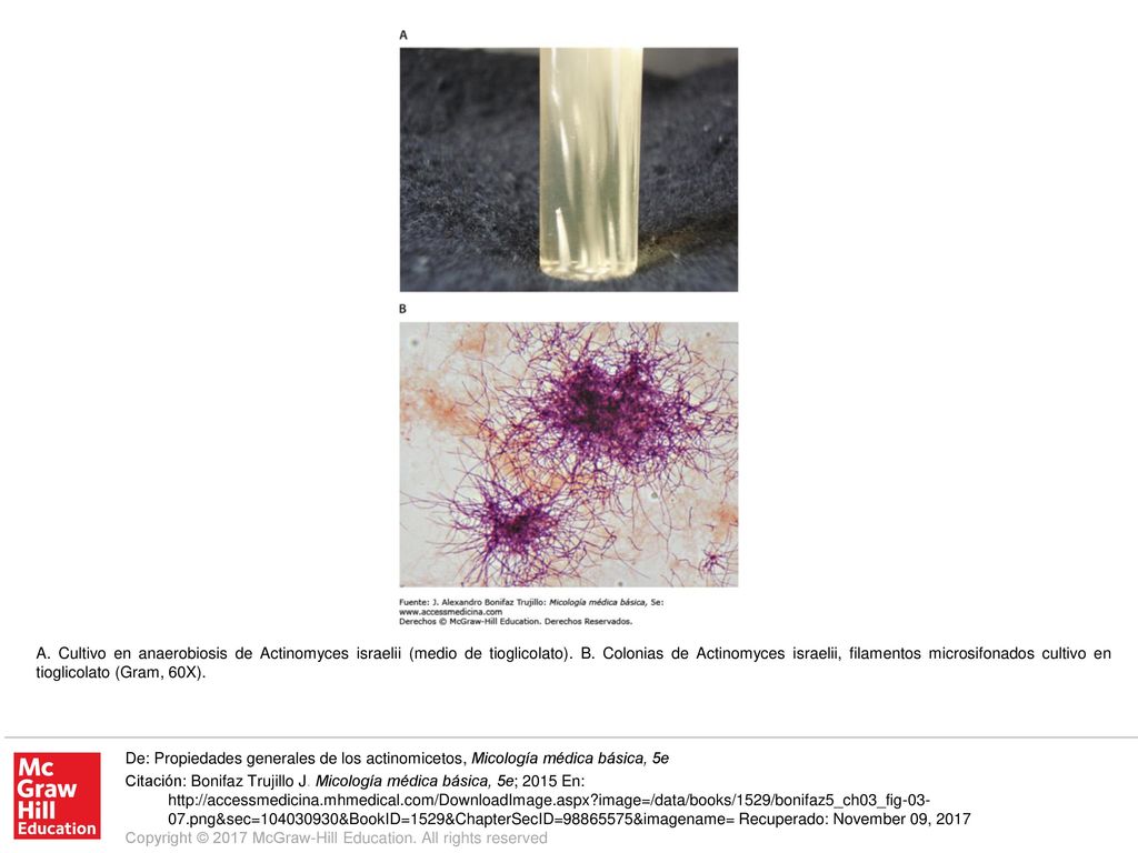A. Cultivo en anaerobiosis de Actinomyces israelii (medio de tioglicolato). B. Colonias de Actinomyces israelii, filamentos microsifonados cultivo en tioglicolato (Gram, 60X).