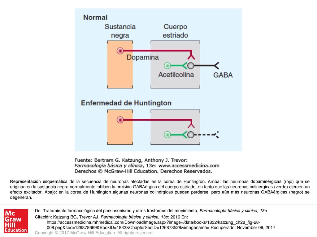 Representación esquemática de la secuencia de neuronas afectadas en la corea de Huntington. Arriba: las neuronas dopaminérgicas (rojo) que se originan en la sustancia negra normalmente inhiben la emisión GABAérgica del cuerpo estriado, en tanto que las neuronas colinérgicas (verde) ejercen un efecto excitador. Abajo: en la corea de Huntington algunas neuronas colinérgicas pueden perderse, pero aún más neuronas GABAérgicas (negro) se degeneran.