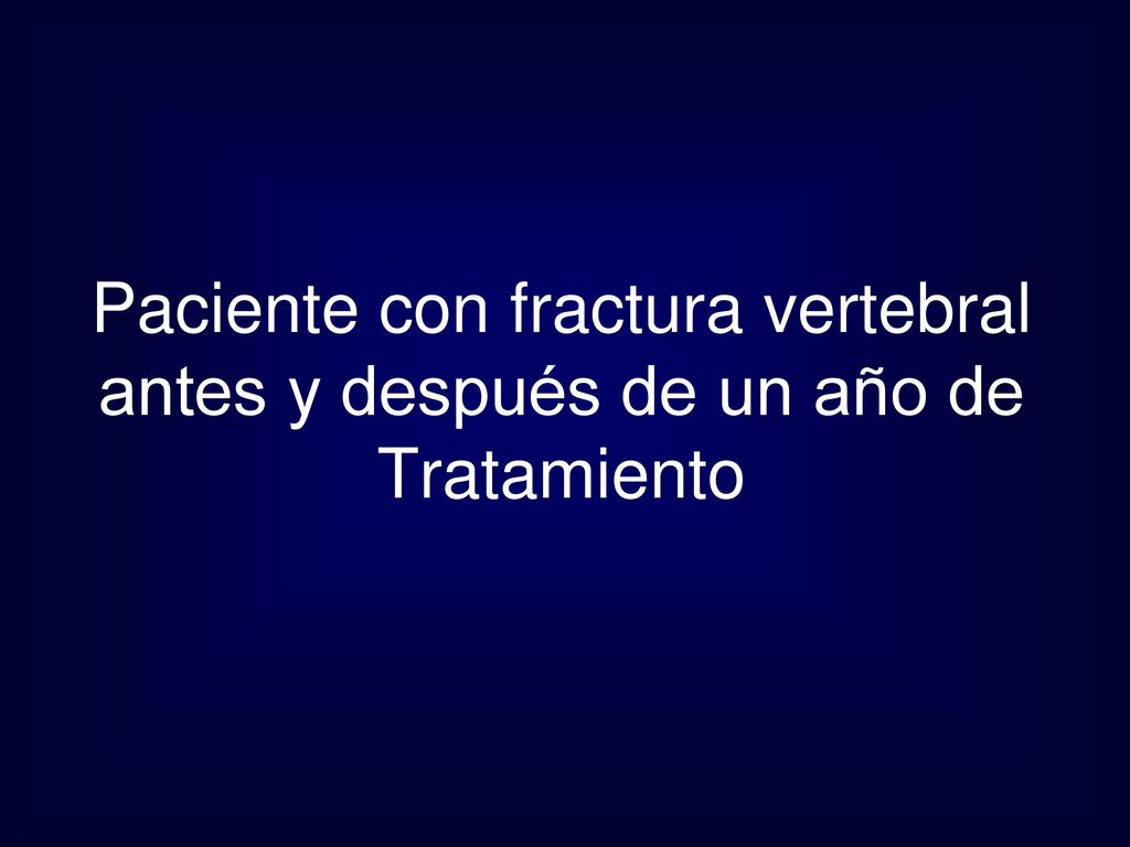 Paciente con fractura vertebral antes y después de un año de Tratamiento