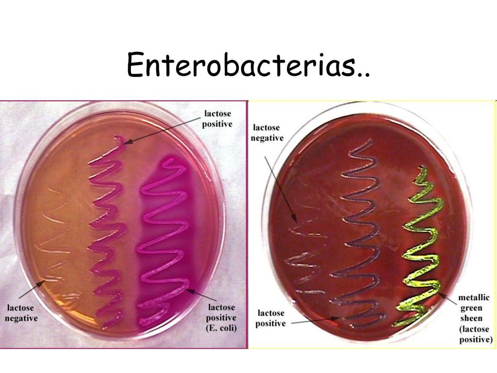 Enterobacterias.. Entre los patógenos más importantes del ser humano tenemos a los géneros. Salmonella : fiebre tifoidea y gastroenteritis.