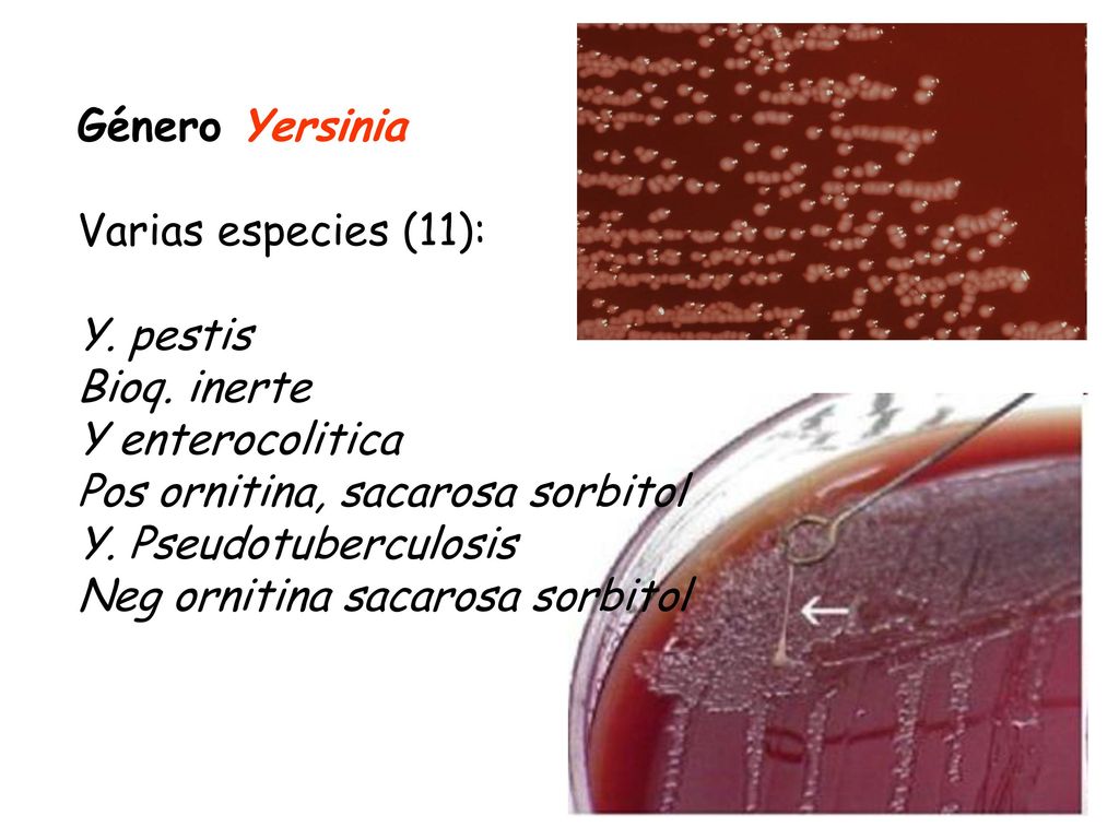 Género Yersinia Varias especies (11): Y. pestis. Bioq. inerte. Y enterocolitica. Pos ornitina, sacarosa sorbitol.