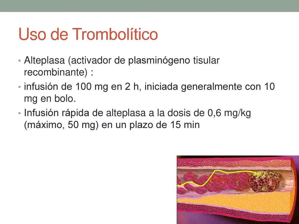 Uso de Trombolítico Alteplasa (activador de plasminógeno tisular recombinante) : infusión de 100 mg en 2 h, iniciada generalmente con 10 mg en bolo.