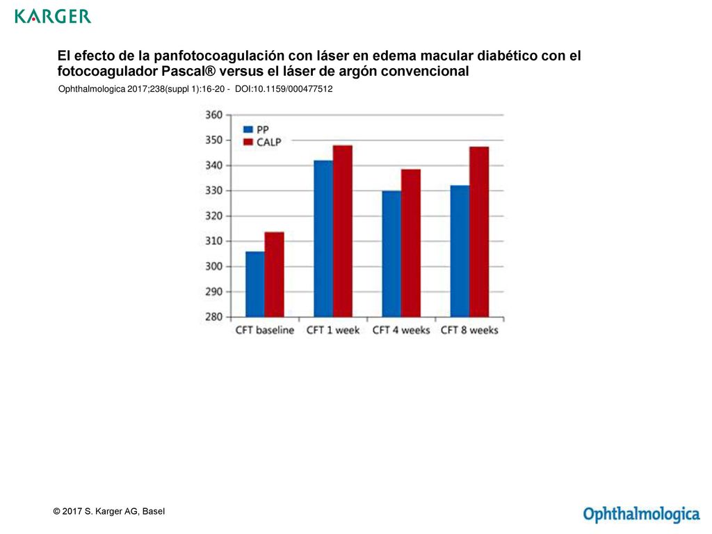 El efecto de la panfotocoagulación con láser en edema macular diabético con el fotocoagulador Pascal® versus el láser de argón convencional