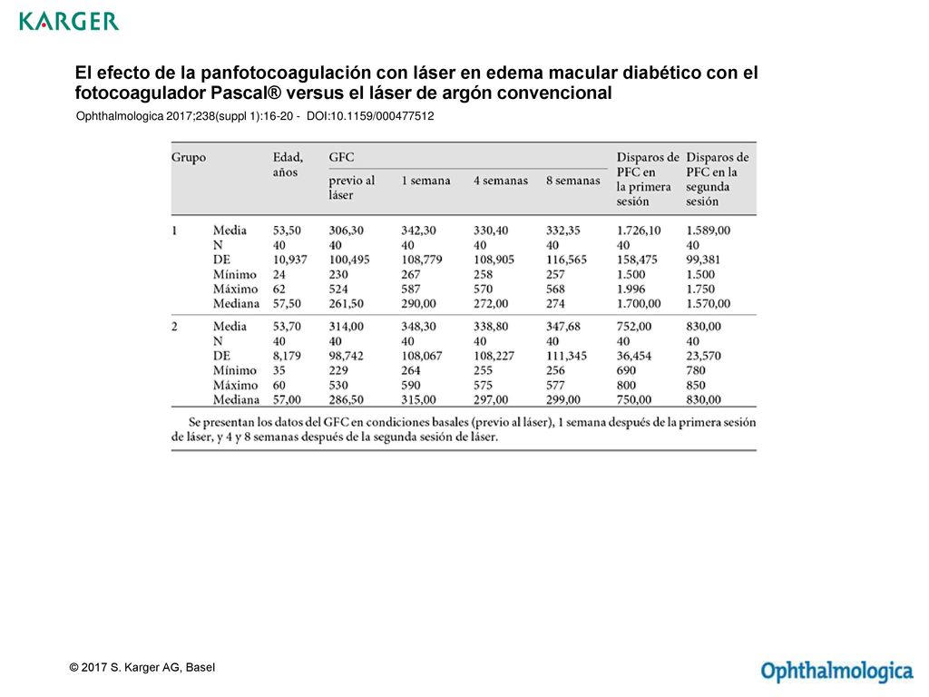 El efecto de la panfotocoagulación con láser en edema macular diabético con el fotocoagulador Pascal® versus el láser de argón convencional