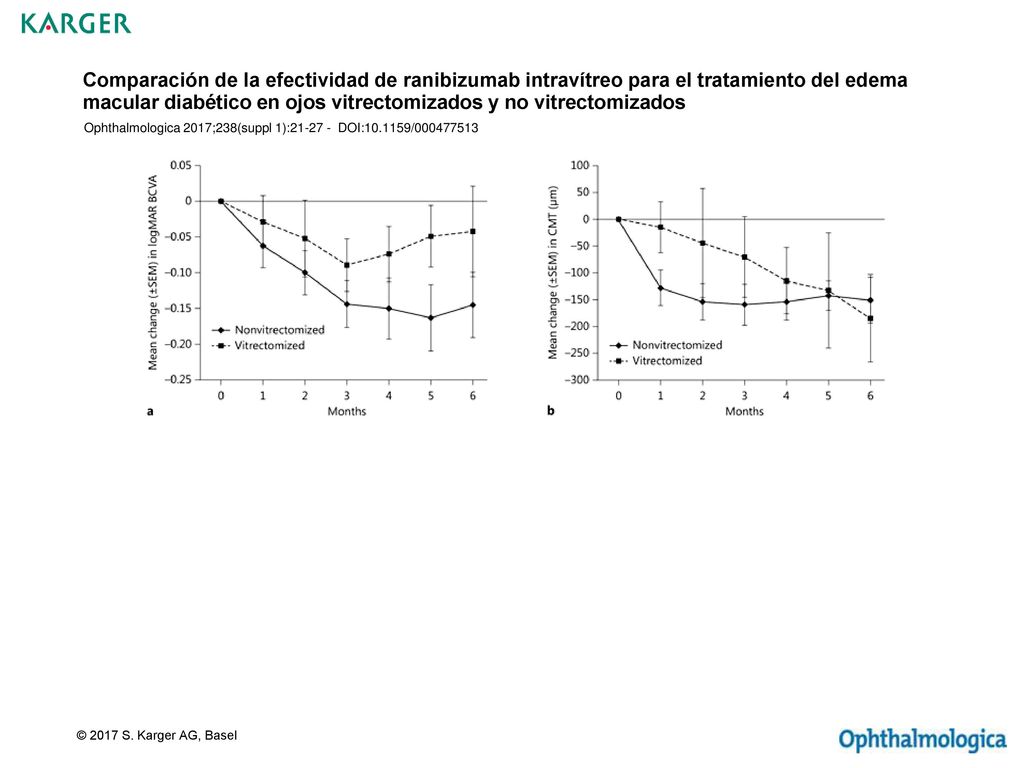Comparación de la efectividad de ranibizumab intravítreo para el tratamiento del edema macular diabético en ojos vitrectomizados y no vitrectomizados