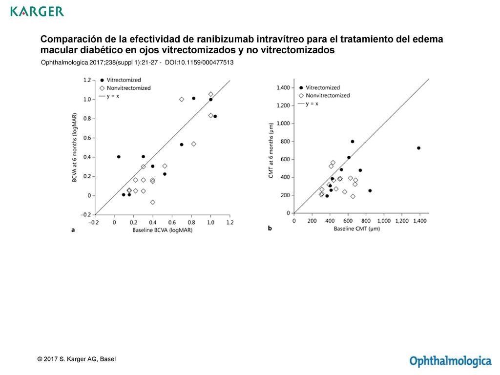Comparación de la efectividad de ranibizumab intravítreo para el tratamiento del edema macular diabético en ojos vitrectomizados y no vitrectomizados