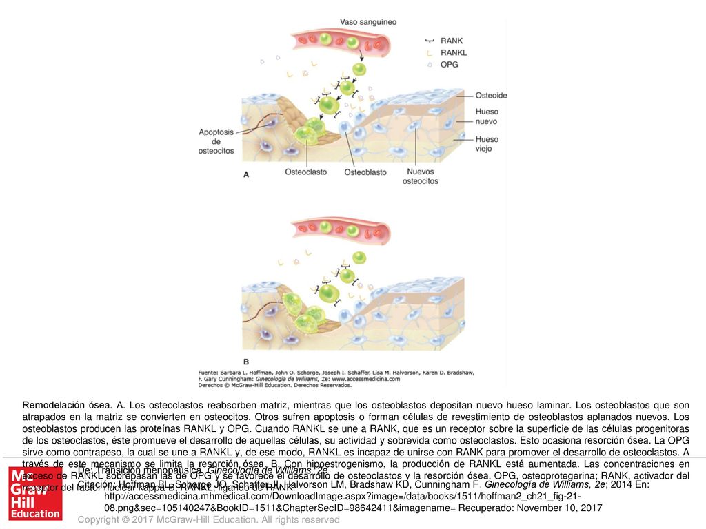 Remodelación ósea. A. Los osteoclastos reabsorben matriz, mientras que los osteoblastos depositan nuevo hueso laminar. Los osteoblastos que son atrapados en la matriz se convierten en osteocitos. Otros sufren apoptosis o forman células de revestimiento de osteoblastos aplanados nuevos. Los osteoblastos producen las proteínas RANKL y OPG. Cuando RANKL se une a RANK, que es un receptor sobre la superficie de las células progenitoras de los osteoclastos, éste promueve el desarrollo de aquellas células, su actividad y sobrevida como osteoclastos. Esto ocasiona resorción ósea. La OPG sirve como contrapeso, la cual se une a RANKL y, de ese modo, RANKL es incapaz de unirse con RANK para promover el desarrollo de osteoclastos. A través de este mecanismo se limita la resorción ósea. B. Con hipoestrogenismo, la producción de RANKL está aumentada. Las concentraciones en exceso de RANKL sobrepasan las de OPG y se favorece el desarrollo de osteoclastos y la resorción ósea. OPG, osteoprotegerina; RANK, activador del receptor del factor nuclear kappa-B; RANKL, ligando de RANK.