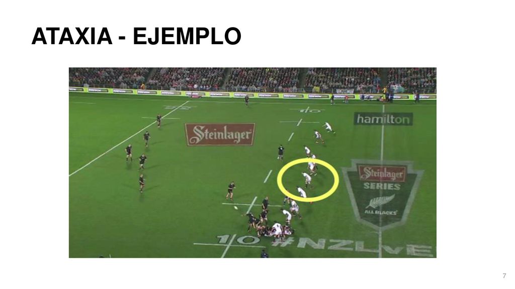 ATAXIA - EJEMPLO Watch 4 White, he is unsteady on rising, unsteady with his early steps and returns to the ground after trying to get back into play.