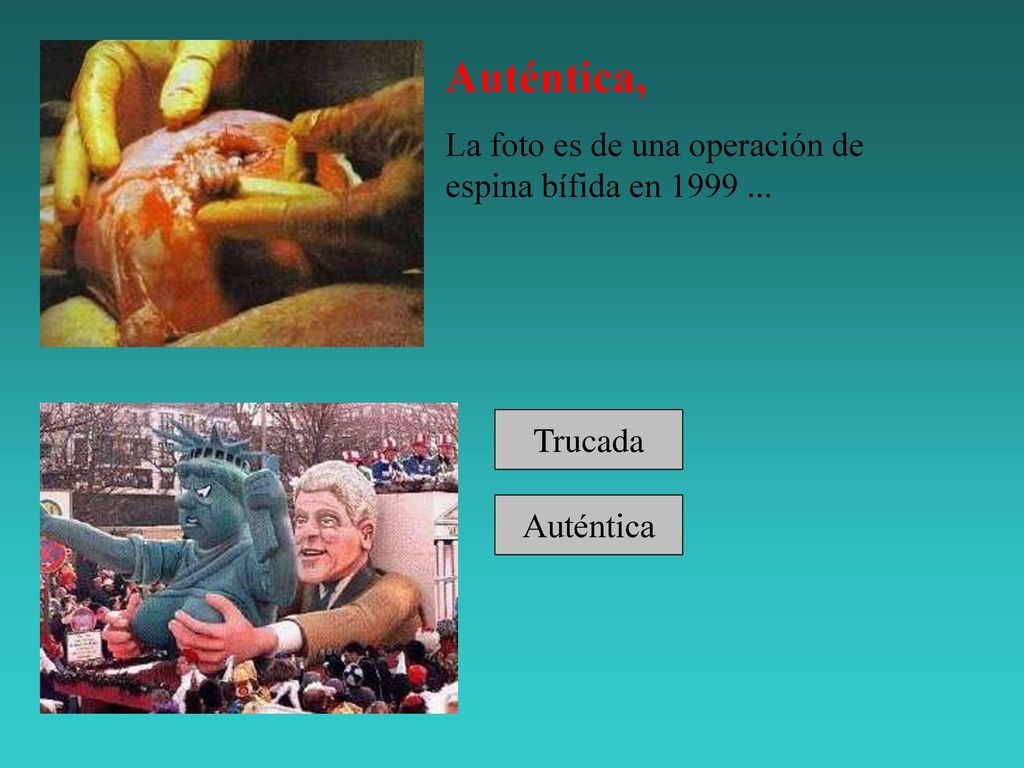 Auténtica, La foto es de una operación de espina bífida en