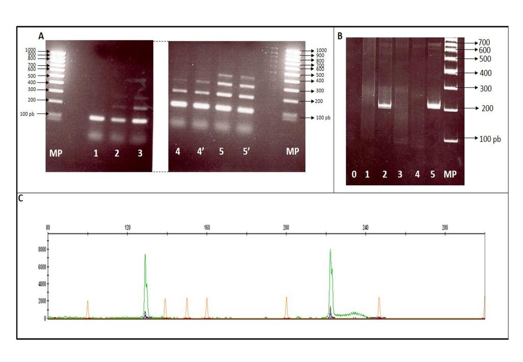 Figura 4. Ejemplos de aplicación de las técnicas de PCR para evaluación de clonalidad linfoide