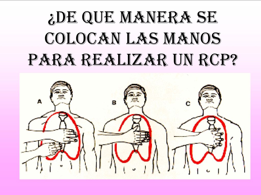 ¿de que manera se colocan las manos para realizar un rcp