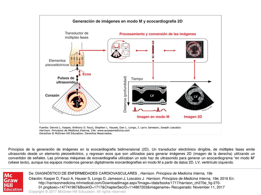 Principios de la generación de imágenes en la ecocardiografía bidimensional (2D). Un transductor electrónico dirigible, de múltiples fases emite ultrasonido desde un elemento piezoeléctrico, y regresan ecos que son utilizados para generar imágenes 2D (imagen de la derecha) utilizando un convertidor de señales. Las primeras máquinas de ecocardiografía utilizaban un solo haz de ultrasonido para generar un ecocardiograma en modo M (véase texto), aunque los equipos modernos generan digitalmente ecocardiografías en modo M a partir de datos 2D. LV, ventrículo izquierdo.