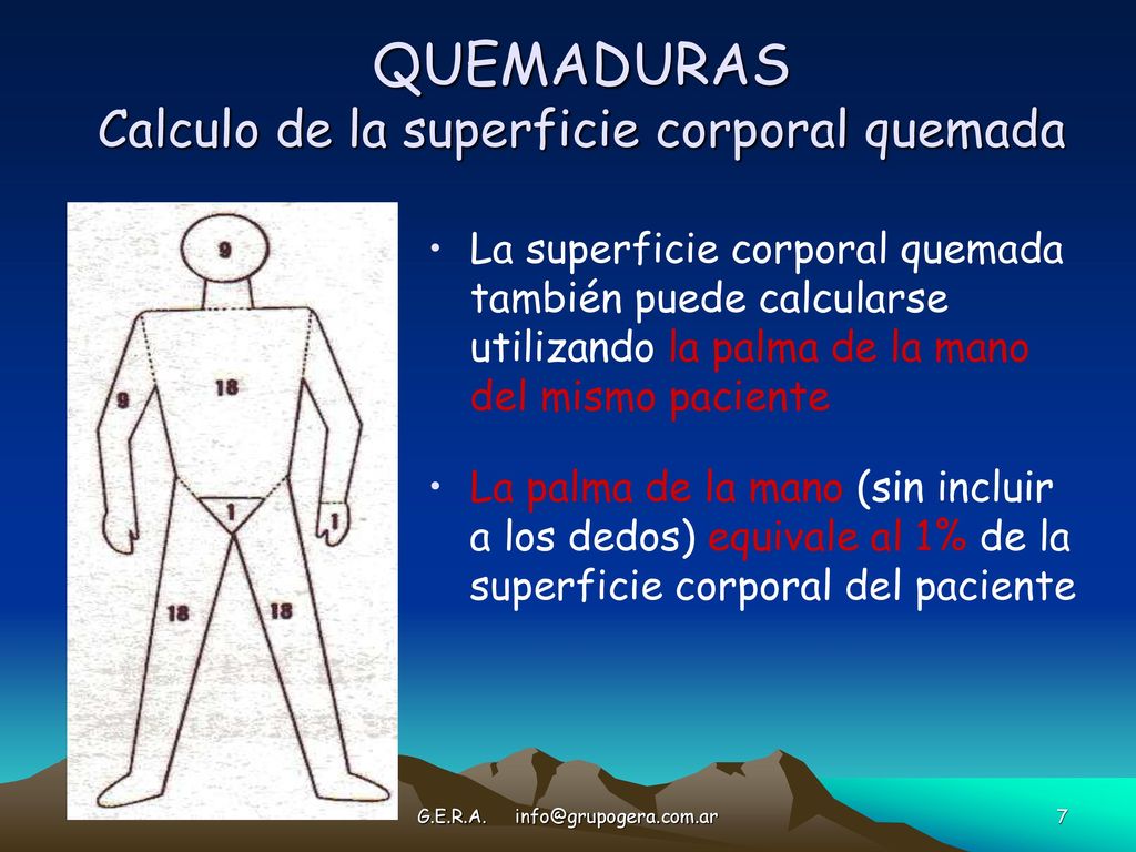 QUEMADURAS Calculo de la superficie corporal quemada