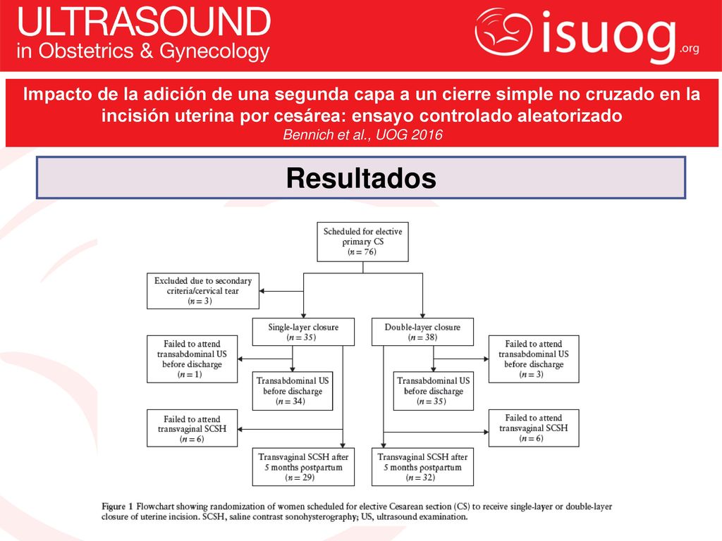 Impacto de la adición de una segunda capa a un cierre simple no cruzado en la incisión uterina por cesárea: ensayo controlado aleatorizado