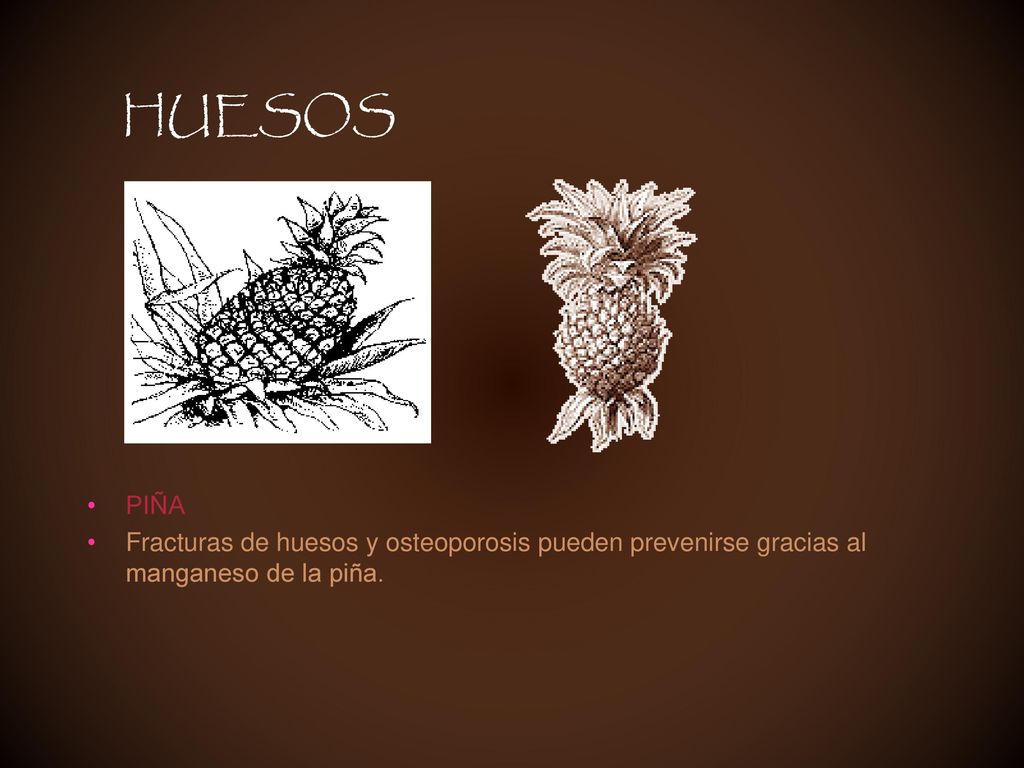 HUESOS PIÑA Fracturas de huesos y osteoporosis pueden prevenirse gracias al manganeso de la piña.