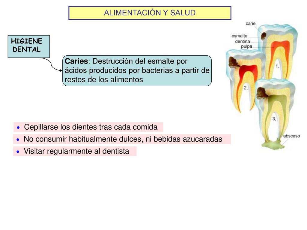 ALIMENTACIÓN Y SALUD HIGIENE DENTAL. Caries: Destrucción del esmalte por ácidos producidos por bacterias a partir de restos de los alimentos.