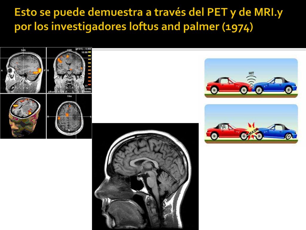Esto se puede demuestra a través del PET y de MRI