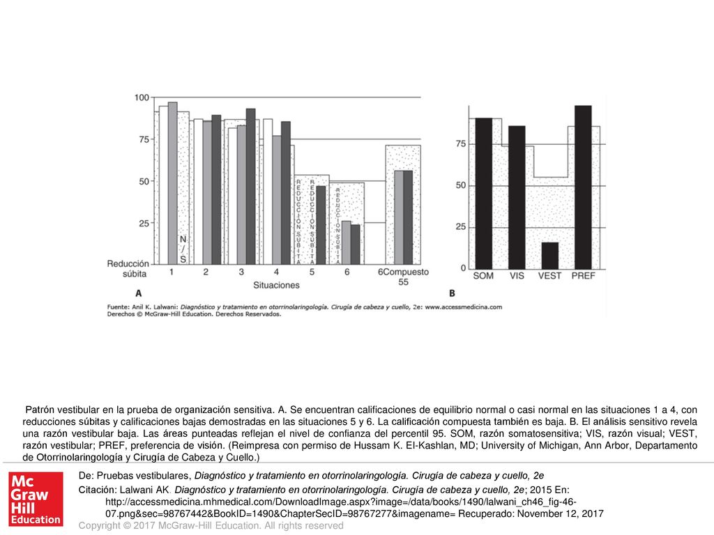 Patrón vestibular en la prueba de organización sensitiva. A