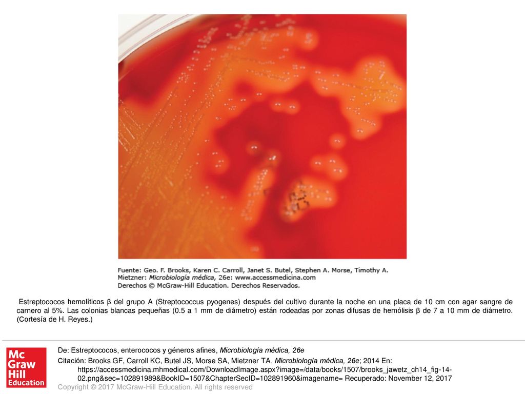 Estreptococos hemolíticos β del grupo A (Streptococcus pyogenes) después del cultivo durante la noche en una placa de 10 cm con agar sangre de carnero al 5%. Las colonias blancas pequeñas (0.5 a 1 mm de diámetro) están rodeadas por zonas difusas de hemólisis β de 7 a 10 mm de diámetro. (Cortesía de H. Reyes.)