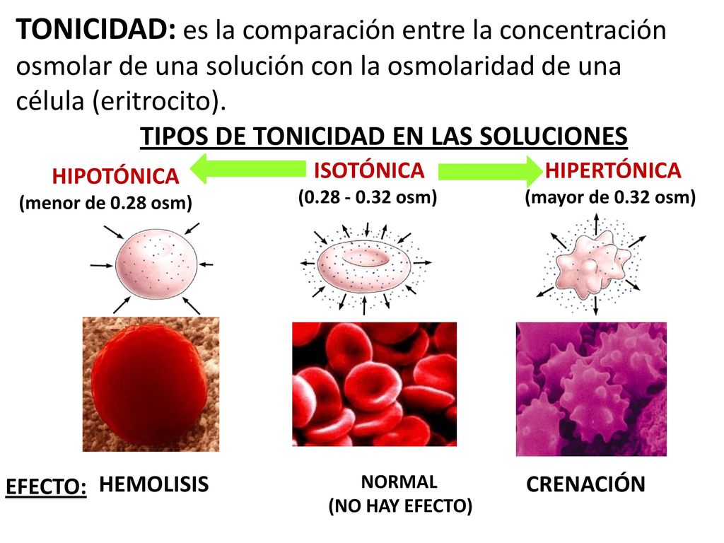 TONICIDAD: es la comparación entre la concentración osmolar de una solución con la osmolaridad de una célula (eritrocito). TIPOS DE TONICIDAD EN LAS SOLUCIONES