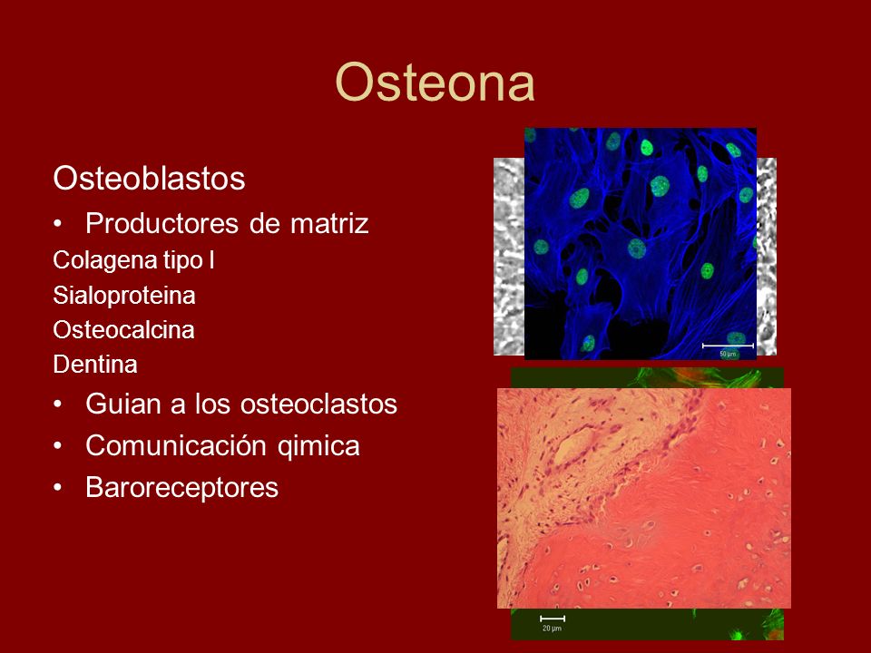 Osteona Osteoblastos Productores de matriz Guian a los osteoclastos