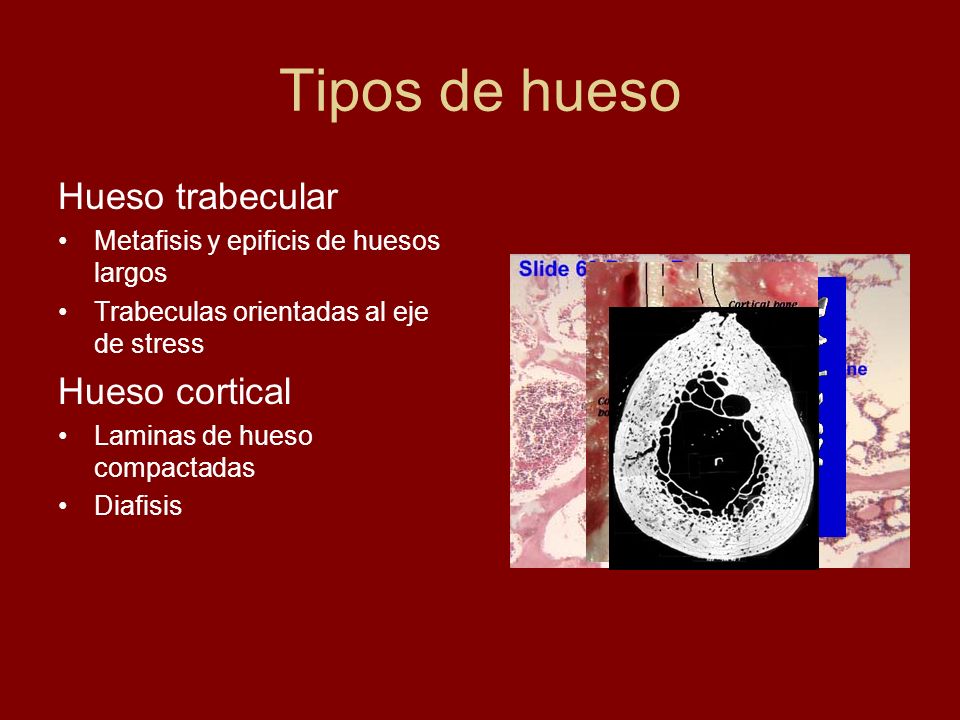 Tipos de hueso Hueso trabecular Hueso cortical