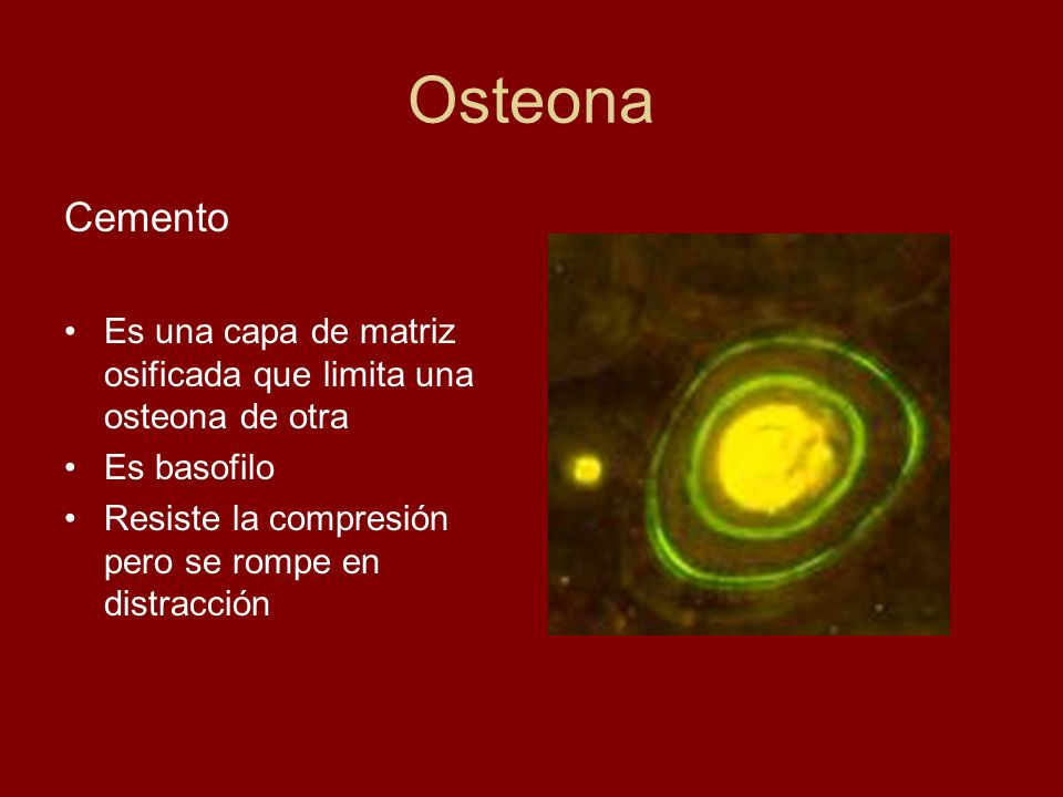 Osteona Cemento. Es una capa de matriz osificada que limita una osteona de otra.