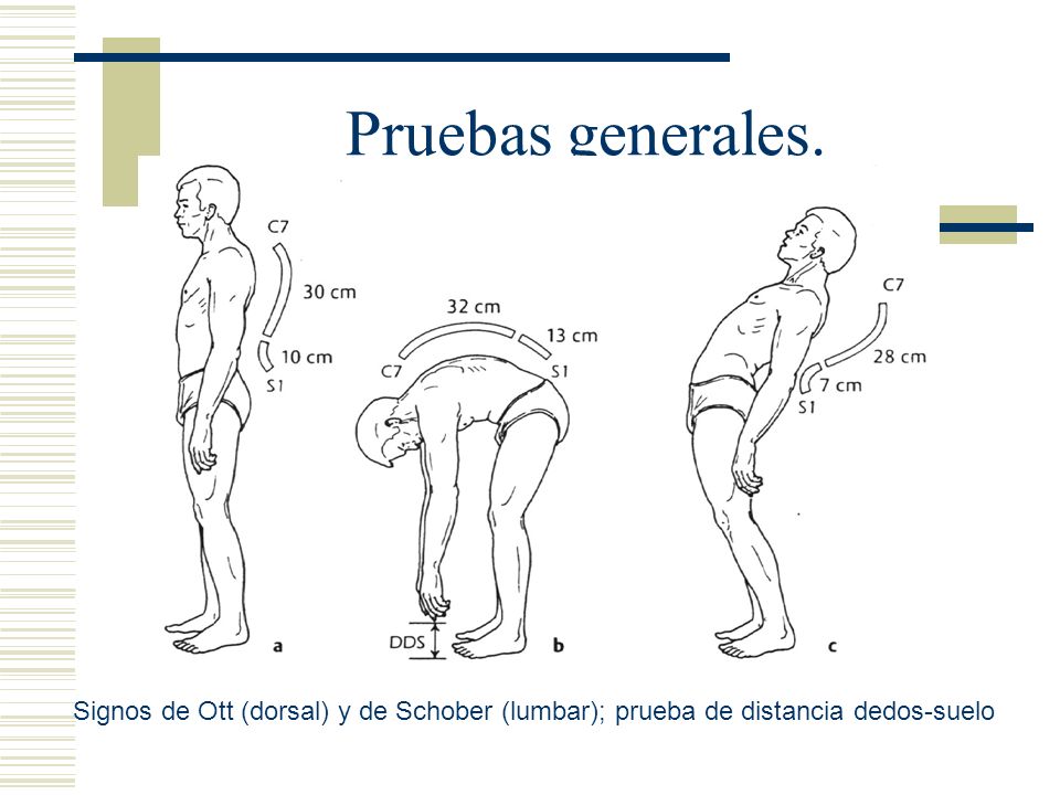 Pruebas generales. Signos de Ott (dorsal) y de Schober (lumbar); prueba de distancia dedos-suelo