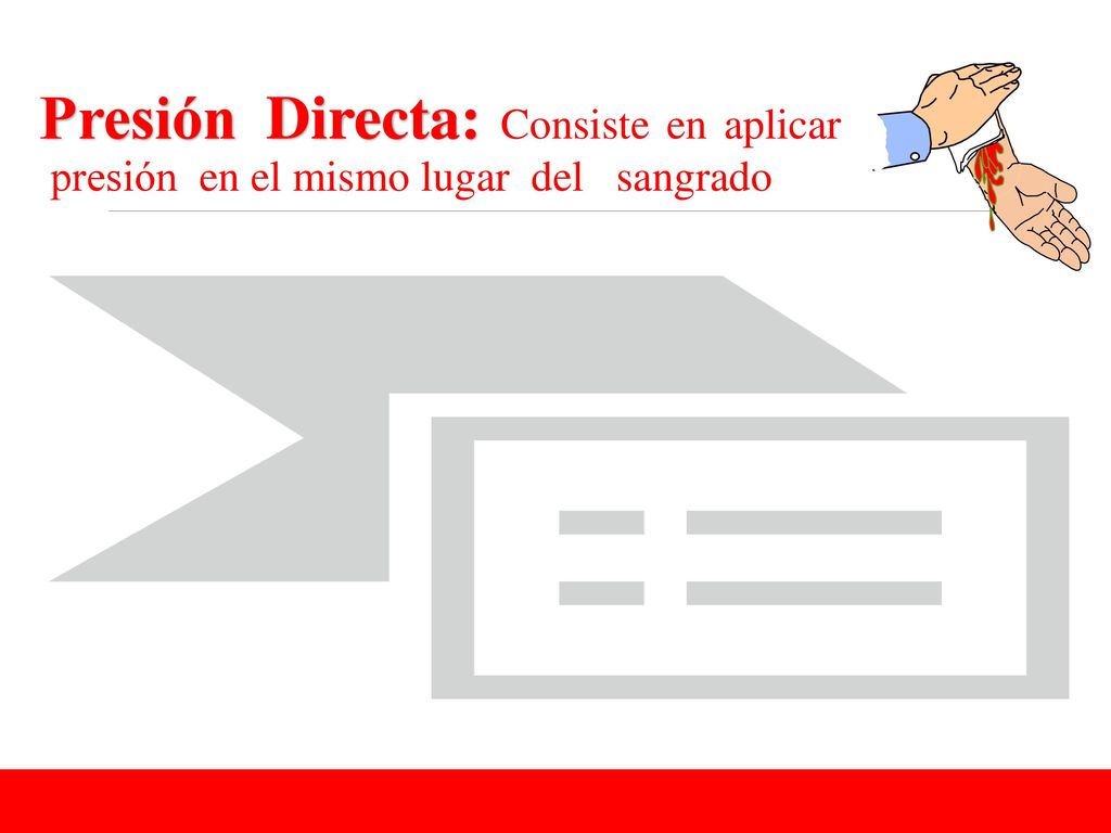Presión Directa: Consiste en aplicar presión en el mismo lugar del sangrado