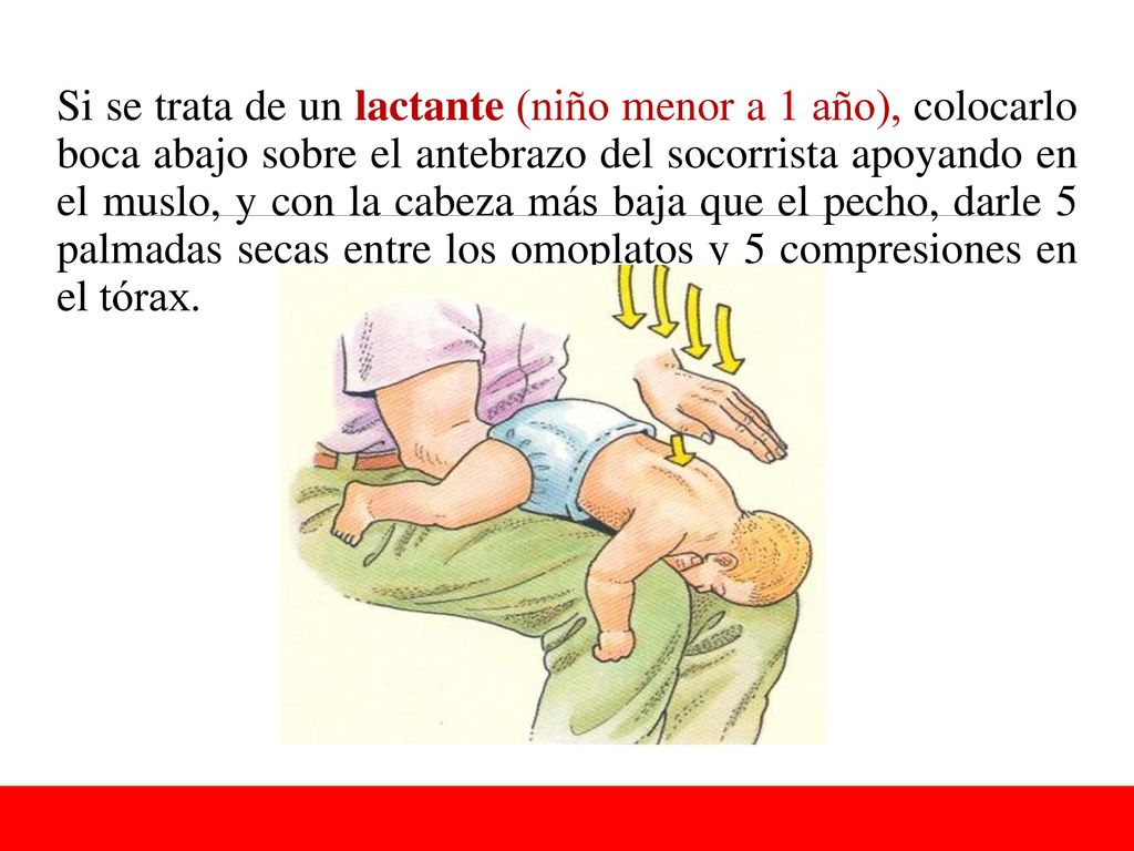 Si se trata de un lactante (niño menor a 1 año), colocarlo boca abajo sobre el antebrazo del socorrista apoyando en el muslo, y con la cabeza más baja que el pecho, darle 5 palmadas secas entre los omoplatos y 5 compresiones en el tórax.