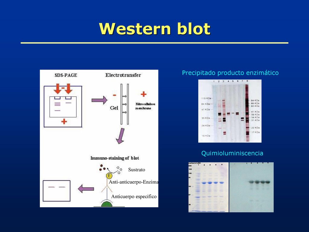 Western blot Precipitado producto enzimático Quimioluminiscencia