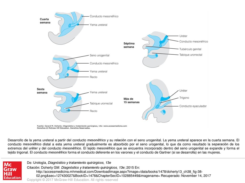 Desarrollo de la yema ureteral a partir del conducto mesonéfrico y su relación con el seno urogenital. La yema ureteral aparece en la cuarta semana. El conducto mesonéfrico distal a esta yema ureteral gradualmente es absorbido por el seno urogenital, lo que da como resultado la separación de los extremos del uréter y del conducto mesonéfrico. El tejido mesonéfrico que se encuentra incorporado dentro del seno urogenital se expande y forma el tejido trigonal. El conducto mesonéfrico forma el conducto deferente en los varones y el conducto de Gartner (si se desarrolla) en las mujeres.
