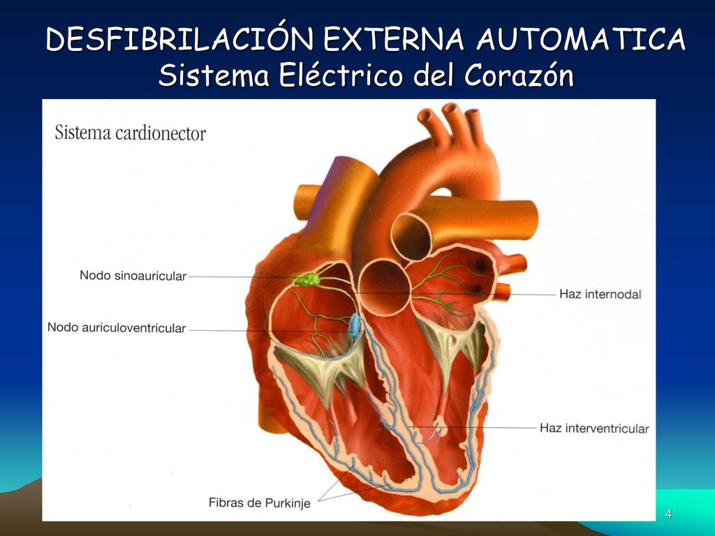 DESFIBRILACIÓN EXTERNA AUTOMATICA Sistema Eléctrico del Corazón
