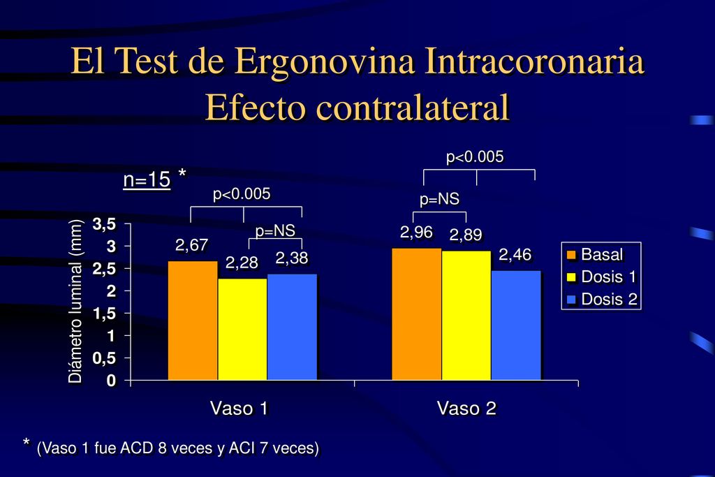 El Test de Ergonovina Intracoronaria Efecto contralateral