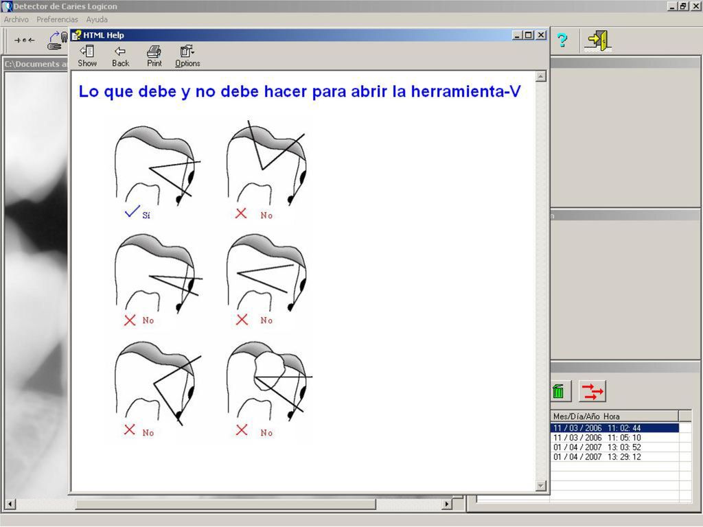 Esta tabla muestra la manera correcta de abrir la herramienta-V y cinco maneras incorrectas.