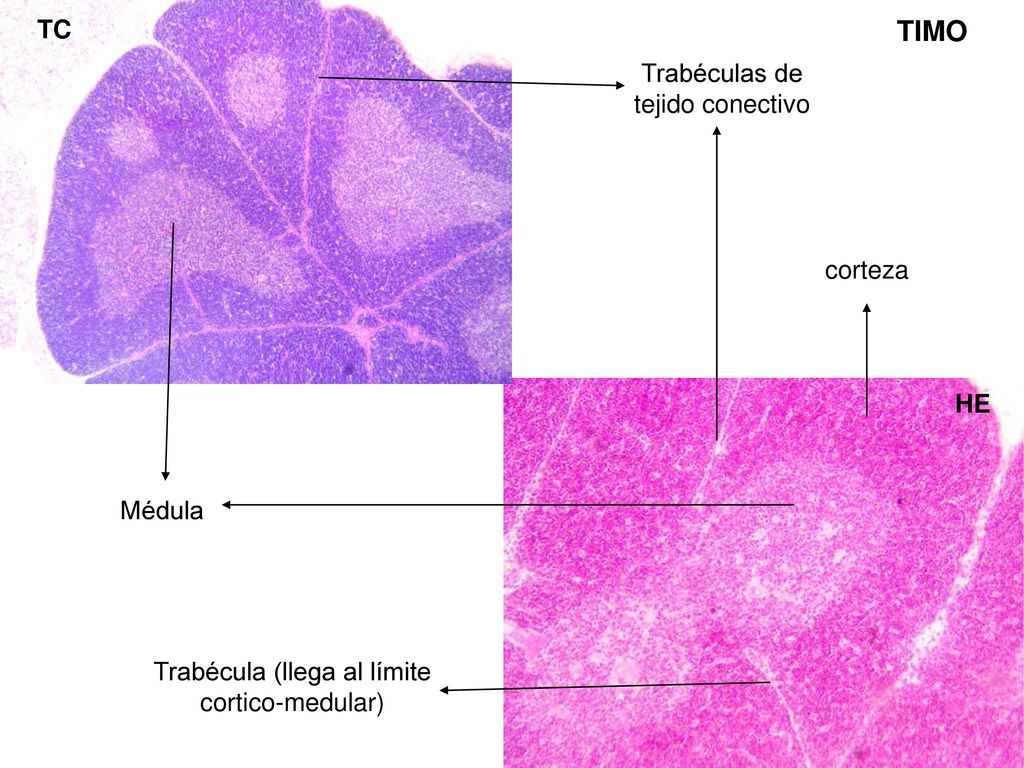 TIMO TC Trabéculas de tejido conectivo corteza HE Médula