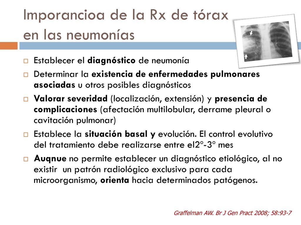 Imporancioa de la Rx de tórax en las neumonías